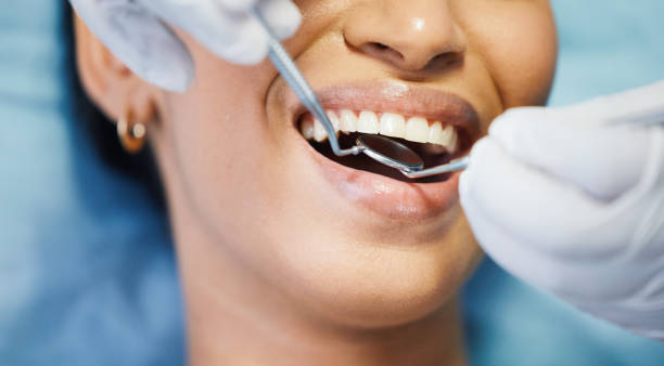 Best Knocked-Out Tooth (Avulsed Tooth) Treatment in Elk Grove Vlage, IL