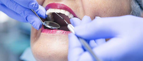 Best Emergency Wisdom Tooth Extraction in Elk Grove Vlage, IL